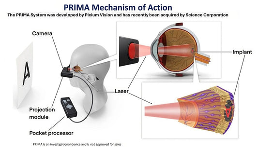 The PRIMA Bionic Vision Chip